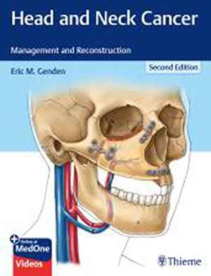 Head and Neck Cancer: Management and Reconstruction  2nd