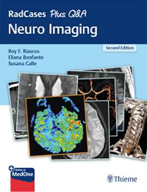 RadCases Plus Q&A Neuro Imaging 2nd