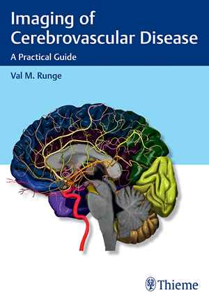 Imaging of Cerebrovascular Disease: A Practical Guide 1st