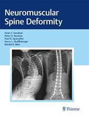 Neuromuscular Spine Deformity 1st