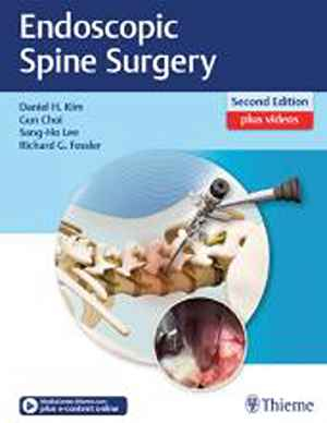 Endoscopic Spine Surgery  2nd
