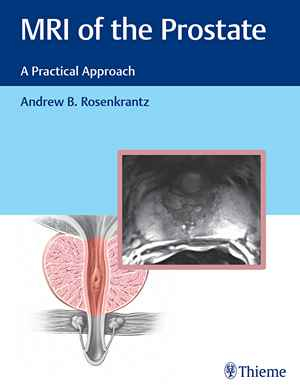 MRI of the Prostate: A Practical Approach 1st