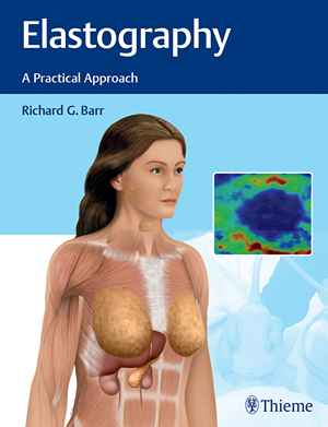 Elastography: A Practical Approach  1st