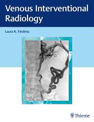 Venous Interventional Radiology  1st