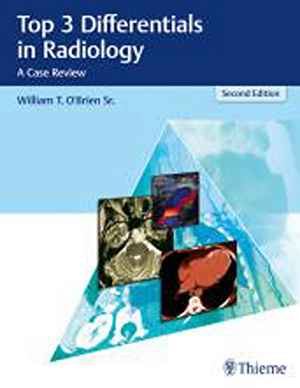 Top 3 Differentials in Radiology: A Case Review  2nd