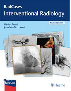 RadCases Q&A Interventional Radiology  2nd