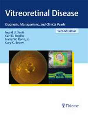 Vitreoretinal Disease: Diagnosis, Management, and Clinical Pearls  2nd