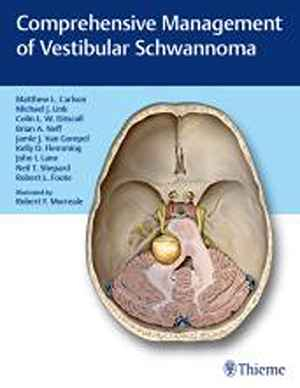 Comprehensive Management of Vestibular Schwannoma 1st