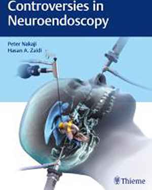 Controversies in Neuroendoscopy 1st