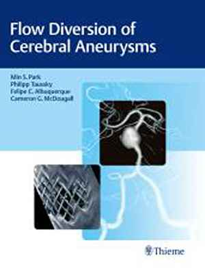 Flow Diversion of Cerebral Aneurysms  1st