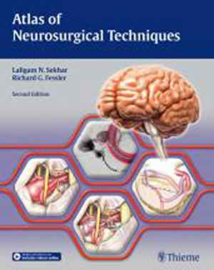 Atlas of Neurosurgical Techniques: Brain 2nd