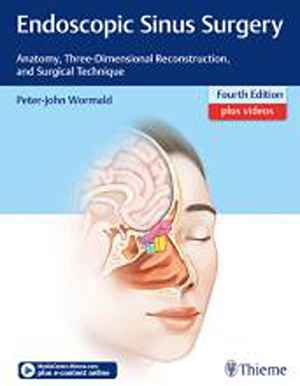 Endoscopic Sinus Surgery: Anatomy, Three-Dimensional Reconstruction, and Surgical Technique  4th