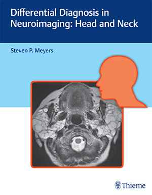 Differential Diagnosis in Neuroimaging: Head and Neck: Head and Neck 1st
