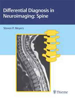 Differential Diagnosis in Neuroimaging: Spine: Spine  1st