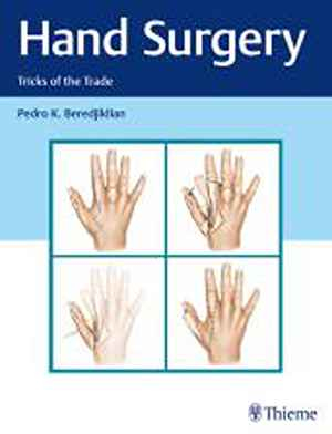 Hand Surgery: Tricks of the Trade 1st