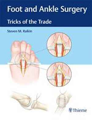Foot and Ankle Surgery: Tricks of the Trade 1st