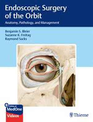 Endoscopic Surgery of the Orbit: Anatomy, Pathology, and Management  1st