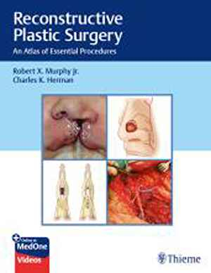Reconstructive Plastic Surgery: An Atlas of Essential Procedures  1st