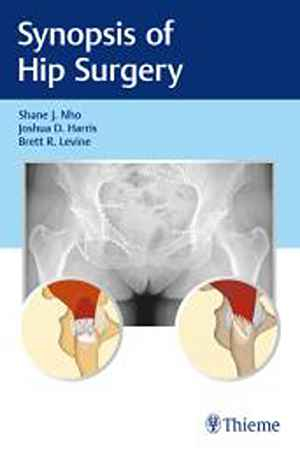 Synopsis of Hip Surgery 1st