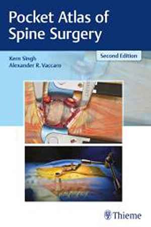 Pocket Atlas of Spine Surgery 2nd
