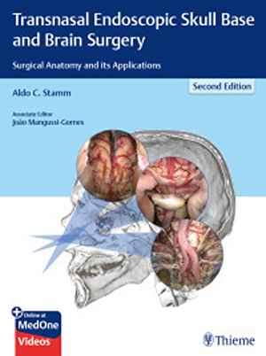 Transnasal Endoscopic Skull Base and Brain Surgery: Surgical Anatomy and its Applications 2nd