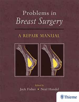 Problems in Breast Surgery: A Repair Manual  1st