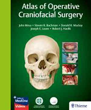 Atlas of Operative Craniofacial Surgery 1st