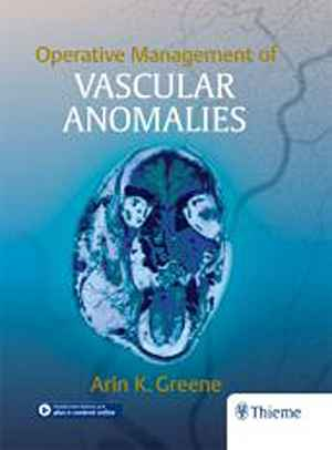 Operative Management of Vascular Anomalies  1st
