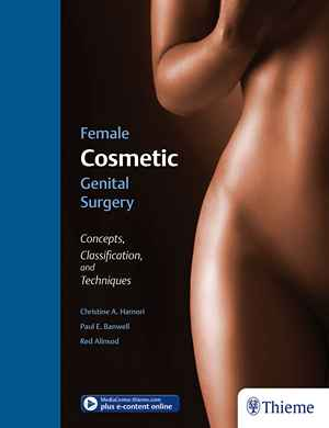 Female Cosmetic Genital Surgery: Concepts, classification, and techniques 1st