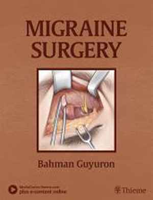 Migraine Surgery 1st