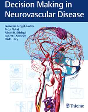 Decision Making in Neurovascular Disease 1st