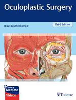 Oculoplastic Surgery 3rd
