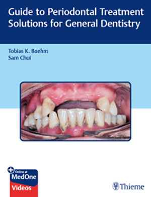Guide to Periodontal Treatment Solutions for General Dentistry 1st