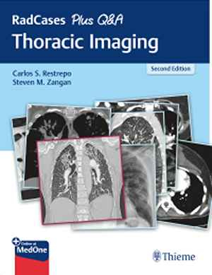 RadCases Plus Q&A Thoracic Imaging  2nd