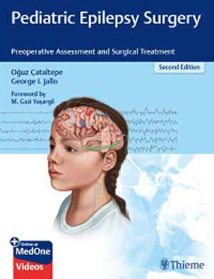 Pediatric Epilepsy Surgery: Preoperative Assessment and Surgical Treatment  2nd