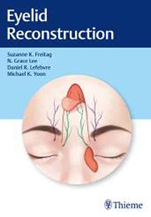 Eyelid Reconstruction  1st