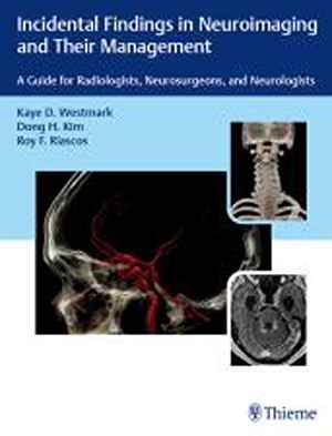 Incidental Findings in Neuroimaging and Their Management: A Guide for Radiologists, Neurosurgeons, and Neurologists  1st