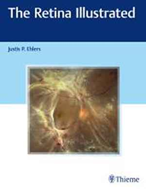 The Retina Illustrated 1st
