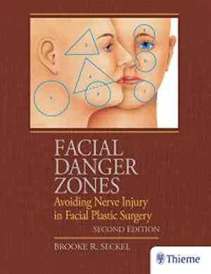 Facial Danger Zones: Avoiding Nerve Injury in Facial Plastic Surgery 2nd
