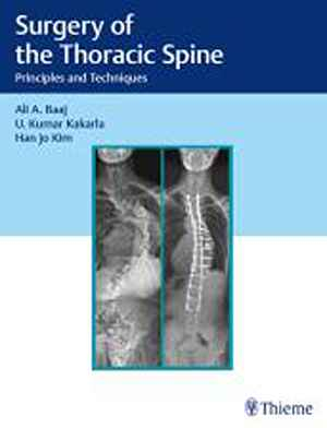 Surgery of the Thoracic Spine: Principles and Techniques 1st