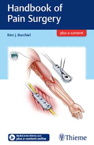 Handbook of Pain Surgery 1st