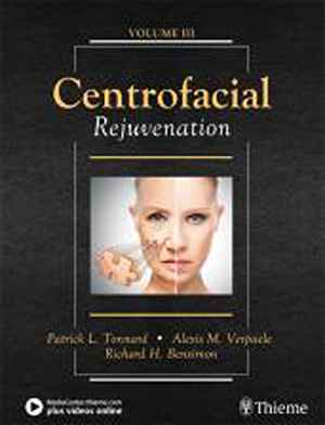 Centrofacial Rejuvenation  1st