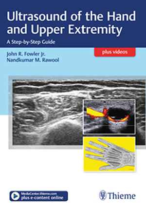 Ultrasound of the Hand and Upper Extremity: A Step-by-Step Guide  1st