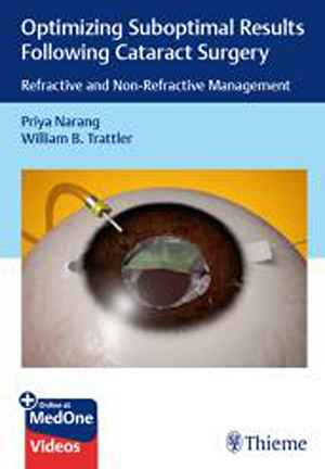 Optimizing Suboptimal Results Following Cataract Surgery: Refractive and Non-Refractive Management 1st