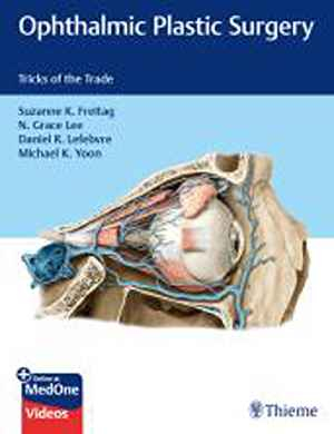 Ophthalmic Plastic Surgery: Tricks of the Trade 1st