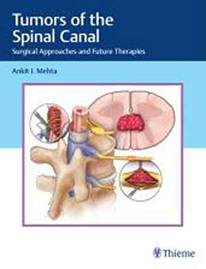 Tumors of the Spinal Canal: Surgical Approaches and Future Therapies  1st