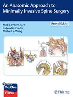 An Anatomic Approach to Minimally Invasive Spine Surgery 2nd