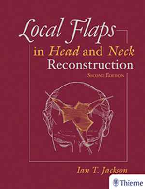 Local Flaps in Head and Neck Reconstruction  2nd
