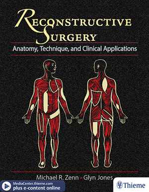 Reconstructive Surgery