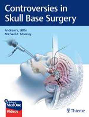 Controversies in Skull Base Surgery  1st